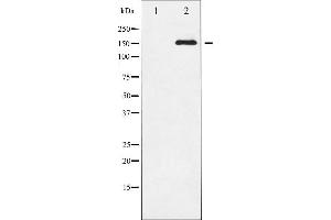 Western blot analysis of VEGFR2 phosphorylation expression in SK-OV3 whole cell lysates,The lane on the left is treated with the antigen-specific peptide. (VEGFR2/CD309 anticorps  (pTyr951))