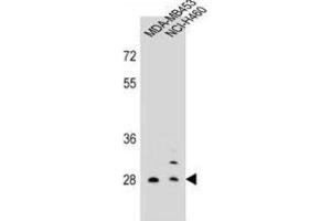 Western Blotting (WB) image for anti-Folate Receptor 2 (Fetal) (FOLR2) antibody (ABIN2998462) (FOLR2 anticorps)