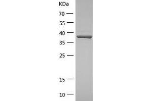 Western Blotting (WB) image for Methionyl Aminopeptidase 1 (METAP1) (AA 1-386) protein (His-IF2DI Tag) (ABIN7123934)