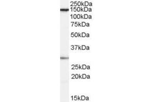 Western Blotting (WB) image for anti-FACT complex subunit SPT16 (SUPT16H) (Internal Region) antibody (ABIN2466335) (SUPT16H anticorps  (Internal Region))