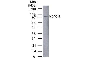 HDAC5 antibody tested by Western blot. (HDAC5 anticorps  (AA 572-587))