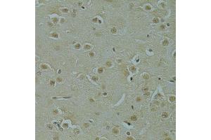 Immunohistochemistry of paraffin-embedded mouse brain using RSRC1 antibody (ABIN6131423, ABIN6147283, ABIN6147284 and ABIN6223040) at dilution of 1:100 (40x lens).