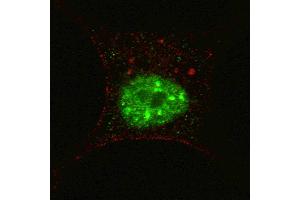 Fluorescent confocal image of SY5Y cells stained with phospho-STAT3- antibody.