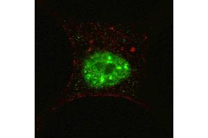 Fluorescent confocal image of SY5Y cells stained with phospho-STAT3- antibody. (STAT3 anticorps  (pSer727))