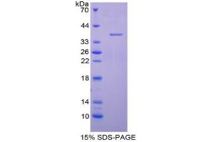 SDS-PAGE analysis of Human AQP1 Protein. (Aquaporin 1 Protéine)