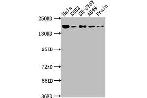 Western Blot Positive WB detected in: Hela whole cell lysate, K562 whole cell lysate, SH-SY5Y whole cell lysate, A549 whole cell lysate, Rat Brain whole cell lysate All lanes: APC antibody at 1:1000 Secondary Goat polyclonal to rabbit IgG at 1/50000 dilution Predicted band size: 312, 301, 309 kDa Observed band size: 160 kDa (Recombinant APC anticorps)