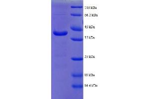 SDS-PAGE (SDS) image for ATP Synthase gamma Chain 1 (ATPC1) (AA 43-161), (partial) protein (GST tag) (ABIN5712073)