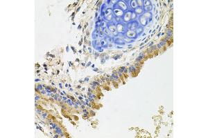 Immunohistochemistry of paraffin-embedded mouse lung using GP2 antibody (ABIN5975023) at dilution of 1/100 (40x lens). (GP2 anticorps)