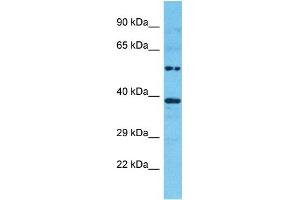 Host:  Rabbit  Target Name:  GAPDH  Sample Type:  Hela Whole Cell lysates  Antibody Dilution:  1.