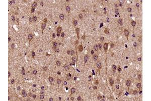 Paraformaldehyde-fixed, paraffin embedded mouse brain, Antigen retrieval by boiling in sodium citrate buffer (pH6) for 15min, Block endogenous peroxidase by 3% hydrogen peroxide for 30 minutes,  Blocking buffer (normal goat serum) at 37°C for 20min, Antibody incubation with Biglycan Polyclonal Antibody (bs-7552R) at 1:400 overnight at 4°C, followed by a conjugated secondary and DAB staining.