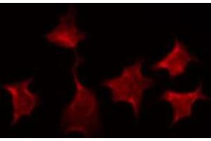 ABIN6266678 staining HepG2 by IF/ICC.