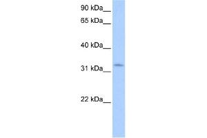 WB Suggested Anti-NRIP2 Antibody Titration:  0. (NRIP2 anticorps  (N-Term))