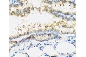 Immunohistochemistry of paraffin-embedded Mouse lung using IFNL3 Polyclonal Antibody at dilution of 1:100 (40x lens). (IL28B anticorps)