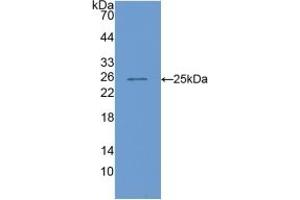 WB of Protein Standard: different control antibodies against Highly purified E.
