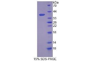 SDS-PAGE analysis of Human SCGB2A2 Protein. (Mammaglobin A Protéine)