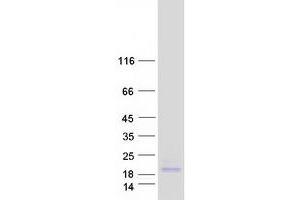 Validation with Western Blot