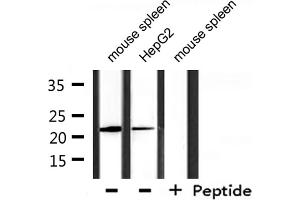 Western blot analysis of extracts from mouse spleen, HepG2, using DIRA1 Antibody. (DIRAS1 anticorps  (C-Term))