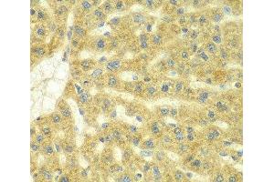 Immunohistochemistry of paraffin-embedded Rat liver using ADCK3 Polyclonal Antibody at dilution of 1:100 (40x lens). (COQ8A anticorps)
