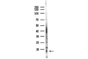Western blot analysis of lysates from 293 cells(UV,30 min treatment), using FABP2 Antibody at 1/1000 dilution.
