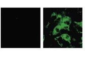 Immunofluorescence (IF) image for anti-SARS-Coronavirus Spike Protein (SARS-CoV S) antibody (ABIN2452119)