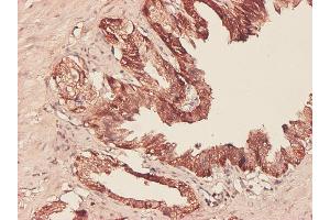 Immunoperoxidase of monoclonal antibody to PHGDH on formalin-fixed paraffin-embedded human prostate.