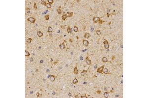 Immunohistochemistry of paraffin-embedded rat brain tissue using SCTR antibody at dilution of 1:200 (x400 lens) (SCTR anticorps)