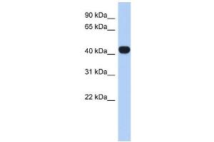 RASGEF1C antibody used at 1 ug/ml to detect target protein. (RASGEF1C anticorps  (N-Term))