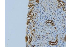 ABIN6272893 at 1/100 staining Mouse kidney tissue by IHC-P. (NBR1 anticorps)