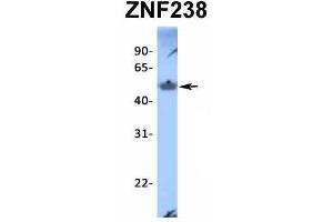 Host:  Rabbit  Target Name:  ZNF238  Sample Type:  Human Fetal Muscle  Antibody Dilution:  1.