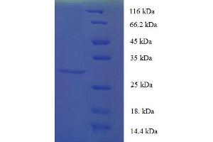 CD82 (CD82) (AA 111-227), (Extracellular) protein (His-SUMO Tag)