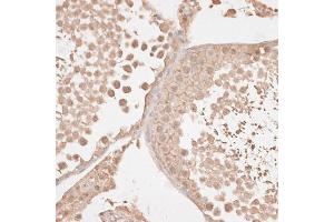 Immunohistochemistry of paraffin-embedded rat testis using VEGF Receptor 2 antibody (ABIN6132247, ABIN6142816, ABIN6142819 and ABIN6215074) at dilution of 1:100 (40x lens).
