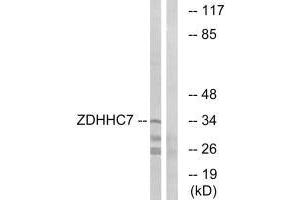 Western blot analysis of extracts from HUVEC cells, using ZDHHC7 antibody. (ZDHHC7 anticorps  (C-Term))
