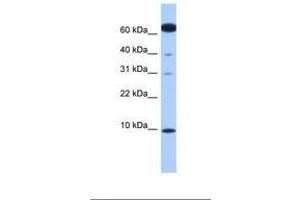 Image no. 1 for anti-Dynein, Light Chain, LC8-Type 1 (DYNLL1) (N-Term) antibody (ABIN6738836)