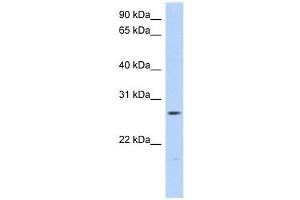 MTHFS antibody used at 1 ug/ml to detect target protein. (MTHFS anticorps)