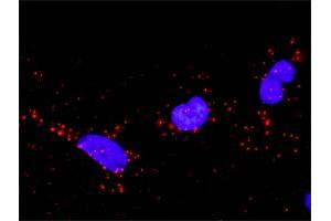 Proximity Ligation Analysis of protein-protein interactions between CRK and SOS1.