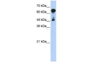 HSPA6 antibody used at 1 ug/ml to detect target protein. (HSPA6 anticorps)