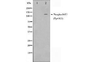 Western blot analysis of JAK1 phosphorylation expression in A549 whole cell lysates,The lane on the left is treated with the antigen-specific peptide. (JAK1 anticorps  (pTyr1022, pTyr1023))