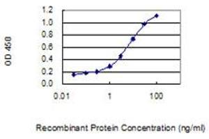 Detection limit for recombinant GST tagged WBSCR27 is 0.