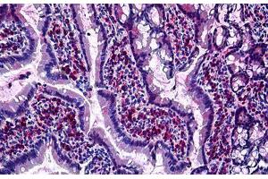 Rat Intestine: Formalin-Fixed, Paraffin-Embedded (FFPE) (GJB2 anticorps  (Cytoplasmic Domain))