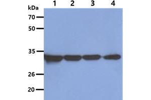 The Cell lysates (40ug) were resolved by SDS-PAGE, transferred to PVDF membrane and probed with anti-human OTUB1 antibody (1:5000).