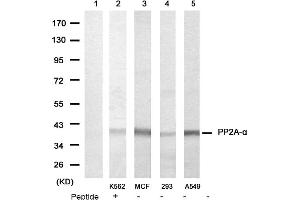 Image no. 1 for anti-Protein Phosphatase 2, Catalytic Subunit, alpha Isozyme (PPP2CA) (N-Term) antibody (ABIN319372) (PPP2CA anticorps  (N-Term))