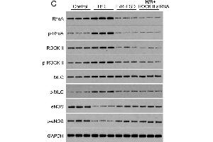 Fasudil protects HUVEC cells from H/R-induced apoptosis(A) MTT was used to determine the IC50 of FSD in HUVEC cells cultured in standard condition. (RHOA anticorps  (pSer188))
