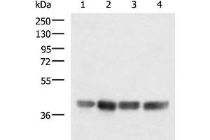 Western blot analysis of LOVO K562 Jurkat and Hela cell lysates using MRPS35 Polyclonal Antibody at dilution of 1:900 (MRPS35 anticorps)