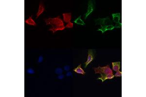 ABIN6259869 and ABIN6267009 staining Hela by IF/ICC. (AKT 1/2/3 anticorps  (C-Term, pan))