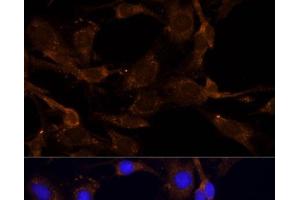Immunofluorescence analysis of C6 cells using RPL27 Polyclonal Antibody at dilution of 1:100 (40x lens). (RPL27 anticorps)