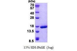 Figure annotation denotes ug of protein loaded and % gel used. (PRND Protéine)