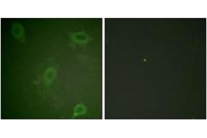 Immunofluorescence analysis of HeLa cells, using Amyloid beta A4 (Phospho-Thr743/668) Antibody. (APP anticorps  (pThr743))