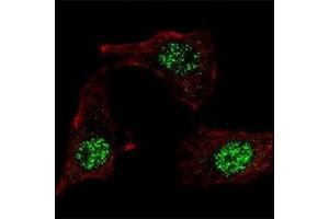 IF staining of HeLa cells with KLF4 antibody at 1:100, response is localized to the nuclei. (KLF4 anticorps  (AA 69-101))