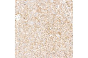 Immunohistochemistry (IHC) image for anti-DEAD (Asp-Glu-Ala-Asp) Box Polypeptide 6 (DDX6) (AA 1-50) antibody (ABIN7453871) (DDX6 anticorps  (AA 1-50))