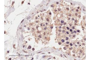 ABIN2559953 (4µg/ml) staining of paraffin embedded Human Testis. (SLC22A16 anticorps  (Internal Region))